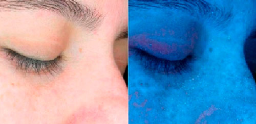 Dermaview